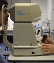 Non-Contact Tonometers
