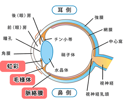 急性前部ぶどう膜炎/図