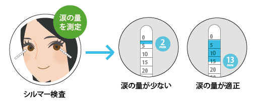 シルマー検査