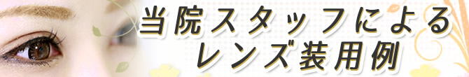 当院スタッフによるレンズ装用例