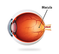 Diabetic Retinopathy