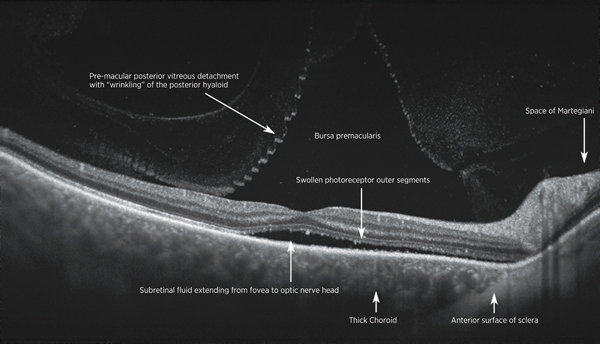 DRI OCT Triton (Optical Coherence Tomography)