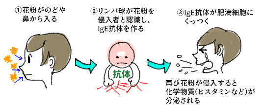 花粉症と症状 池袋サンシャイン通り眼科診療所