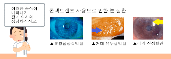 이러한 증상이 나타나기 전에 의사와 상담하십시오.