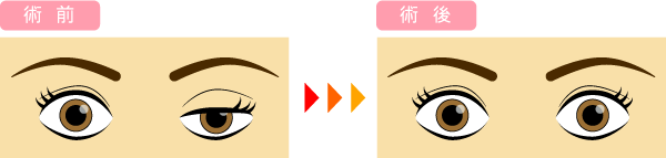 ボツリヌス療法